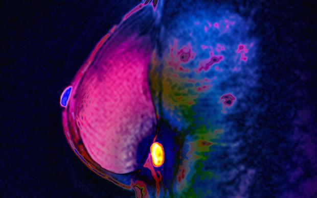 A close-up image of a woman's breast scan