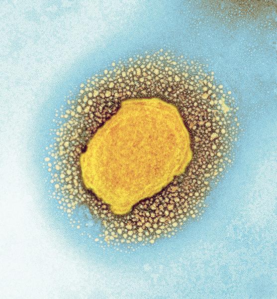 Image of the monkey pox virus