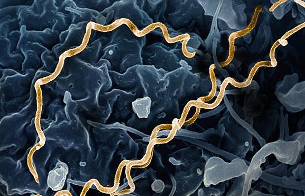 Electron micrograph image of T. pallidum, highlighted in gold